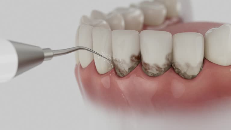 Trusted Root Canal Treatment service in Almedia, PA - Dentist Open Now